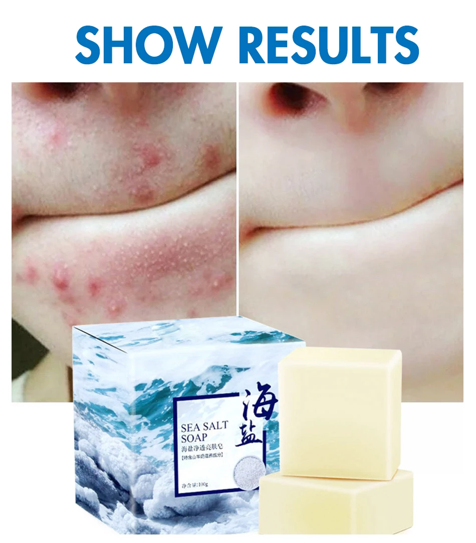 

Sea Salt Soap Cleaner Removal Pimple Pores Acne Treatment Goat Milk Moisturizing Face Care Wash Basis Soap Base Skin Care