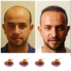 Shampoo do crescimento do cabelo do shampoo para o crescimento rápido do cabelo inibe a perda tratamento do reparo do cabelo dos shampoos da regeneração do tratamento do cabelo