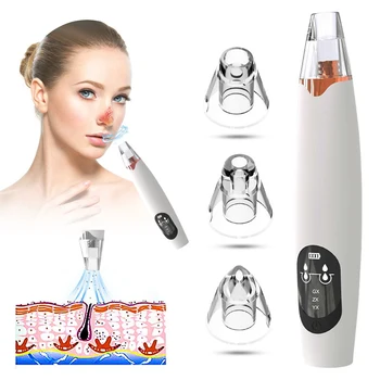 

Blackhead Removal Skin Care Pores Vacuum Suction Acne Removal Tool
