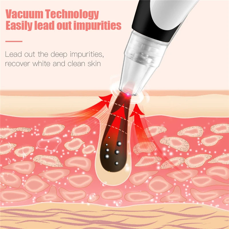 CkeyiN Blackhead Remover Vacuum Pore Vacuum Cleaner Face Acne Comedone Extractor Tool + Warm Mist Facial Steamer Face Brush 50