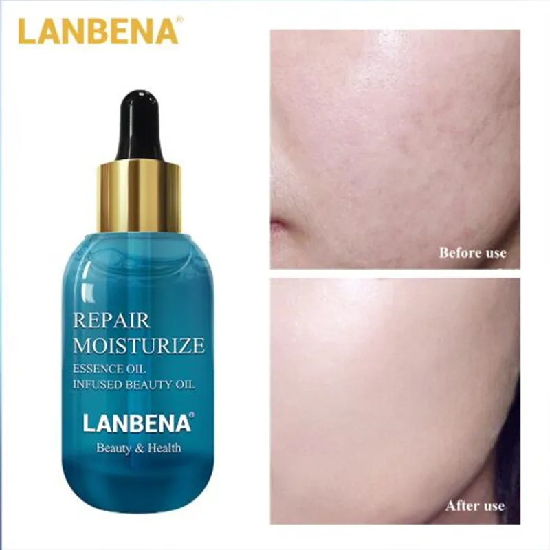 LANBENA Repair Face Serum Hyaluronic Acid Serum For Skin Repair Nourishing Moisturizing Firming Anti Aging Anti 2