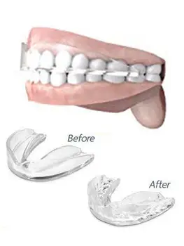 

Silicone Mouth Guard Teeth Dental Protection Anit Snore- Stop Night Teeth Grinding Safety Orthodontic Brace Buck Teeth Retainer