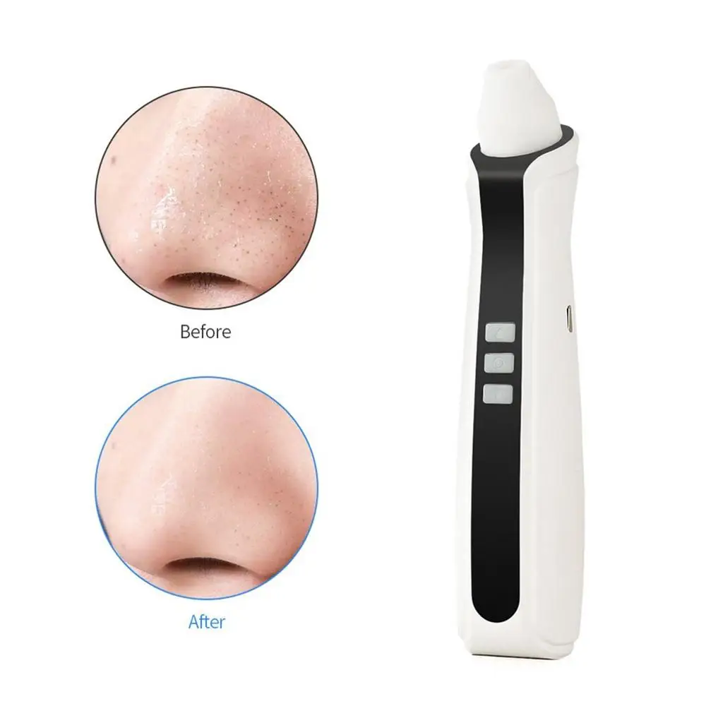 

USB Rechargeable Visual Blackhead Remover Facial Pores Black Head Cleaner Vacuum 500X WIFI Microscope Camera