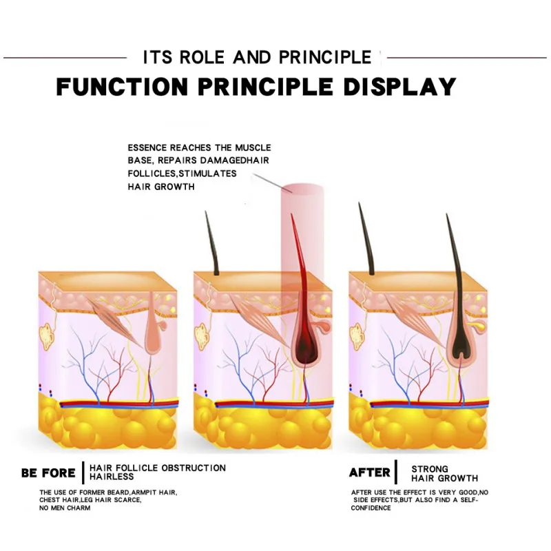 Мужской рост бороды эфирное масло утолщенная борода масло волосяного фолликула ремонт Эфирное масло 20 мл анти борода продукты для выпадения волос pro