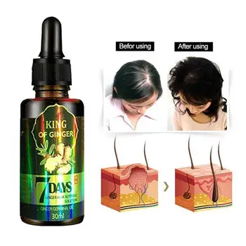 

30ml Ginger Hair Growth Nutrient Solution Hair Loss Treatment Hair Protection Essential Oil for Men Women
