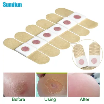 

72pcs Foot Care Medical Plaster Foot Corn Removal Calluses Plantar Warts Thorn Pain Relieving Patch Toe Protector Stickers Pads