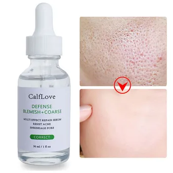 

Salicylic Acid Shrink Pores Face Serum Essence Pore Treatment Moisturizing Hyaluronic Acid Purify Repair Oil Control Skin Care