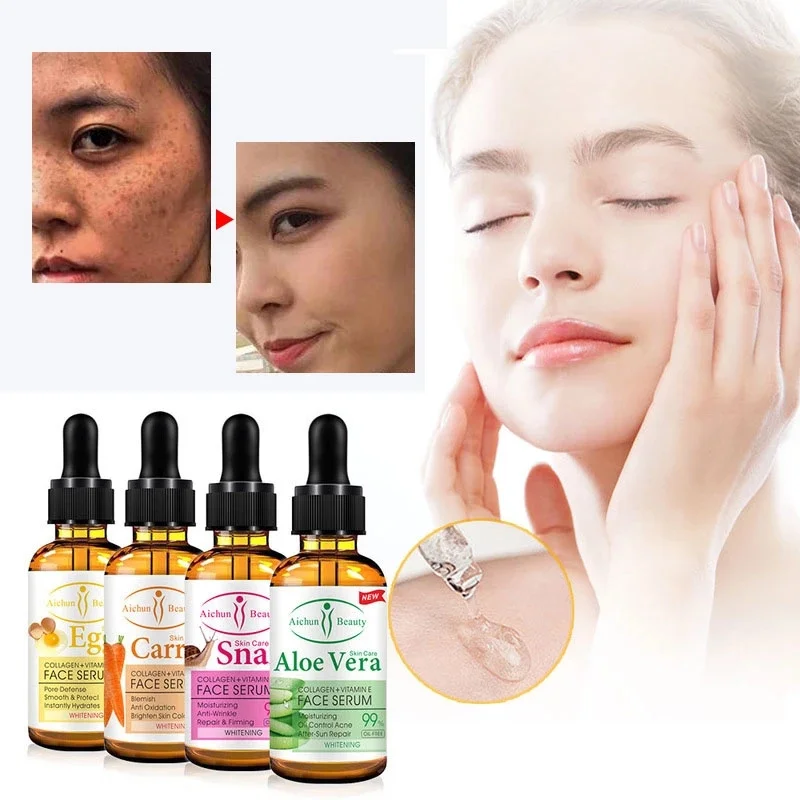 Correttore spot Sbiancamento scuro Siero sbiancante per il viso Illuminare le imperfezioni Rimozione delle lentiggini Essenza naturale di carota Corea_voghion.com