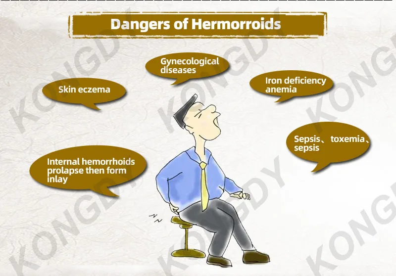 KONGDY 1 шт. крем от геморроя снимает Анальная боль китайский пластырь для внутреннего геморроя сваи внешняя Анальная мазь