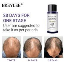 1 шт. Уход за волосами эссенция масло лечение роста против выпадения волос эффективное питает предотвращает облысение V9-Drop