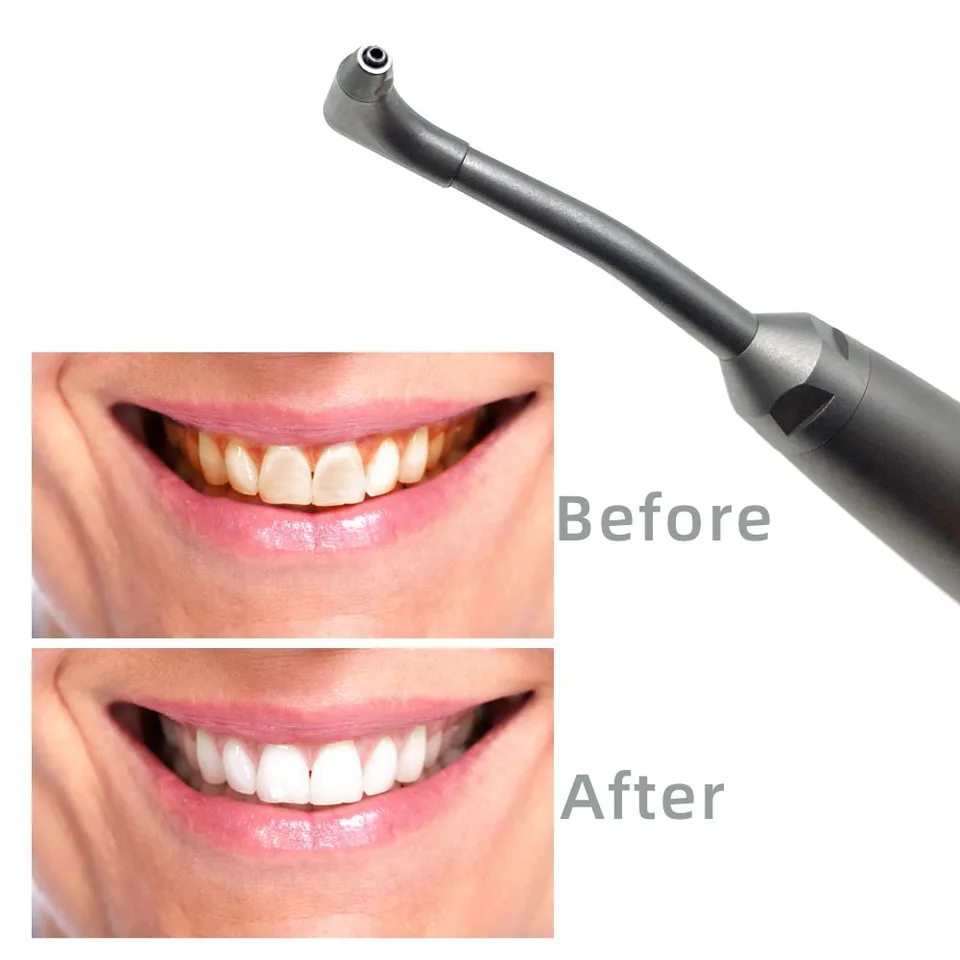 歯科用ハンドピース,nsk,便利な作業,e-mate,needis,口腔衛生,作業,理髪