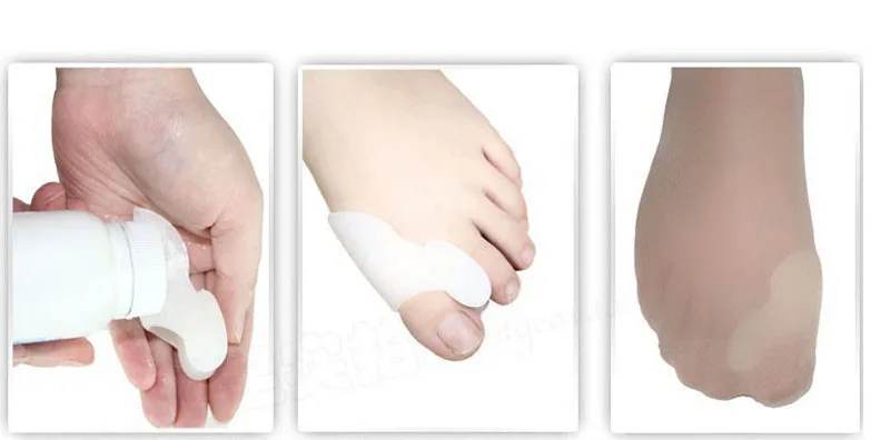 Silicone Gel Foot Fingers Toe Separator Thumb Valgus Protector Bunion Adjuster Hallux Valgus Pro Guard Feet Care (2)