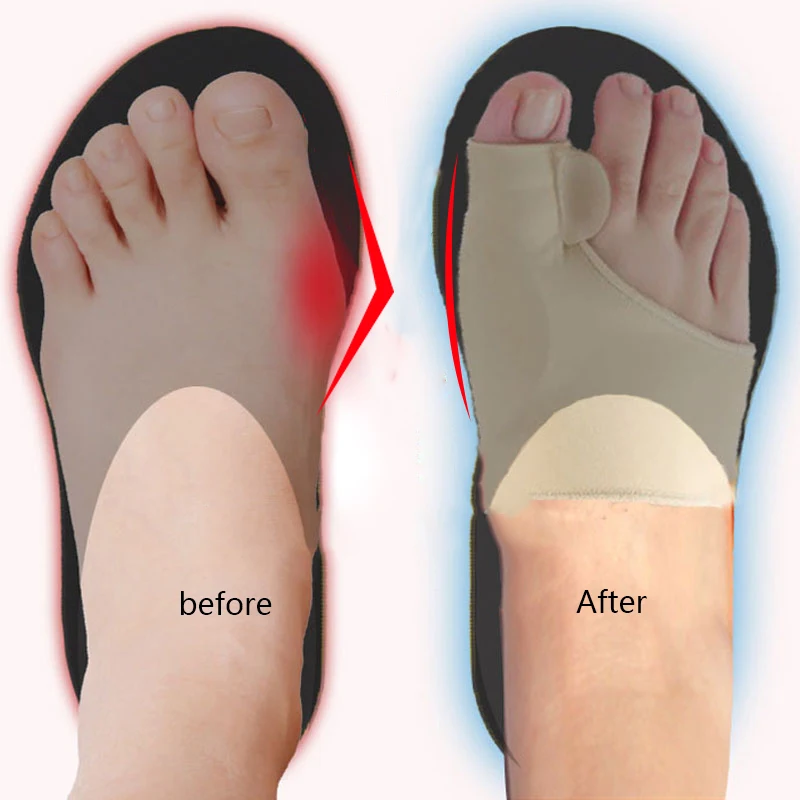 Big Toe Splint Separator Hallux Valgus Bunion Corrector Orthotic Feet Care Thumb Adjuster Correction Pedicure Socks Straightener