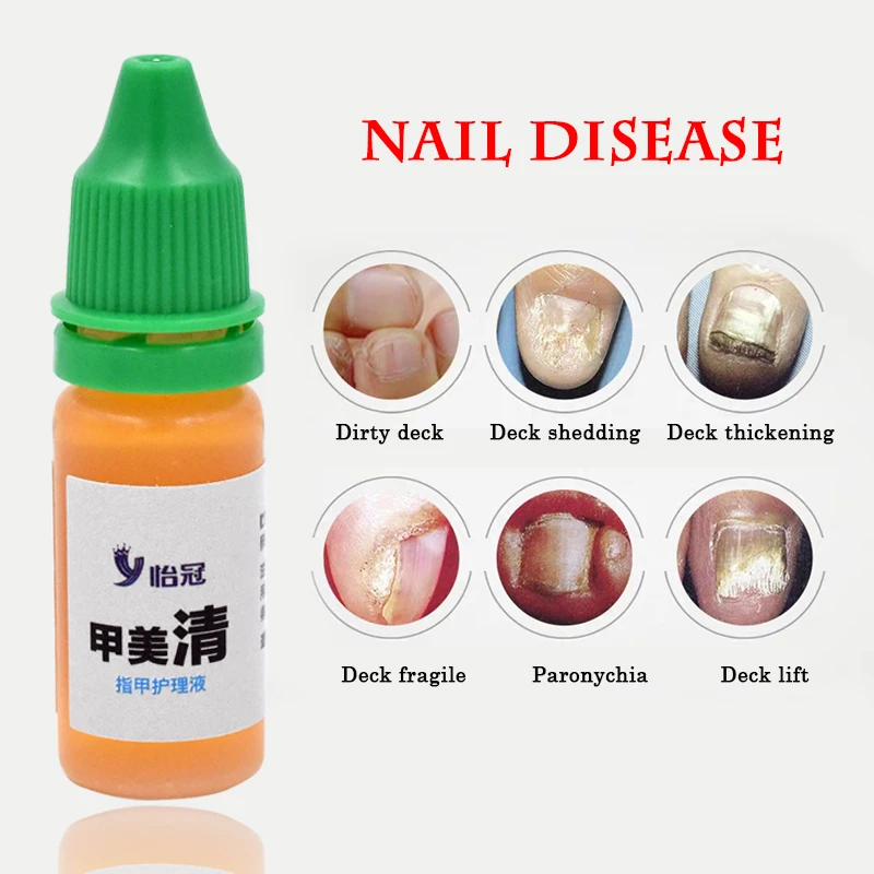 Hf1e0572dfdbe41498836b17f340df5bcU