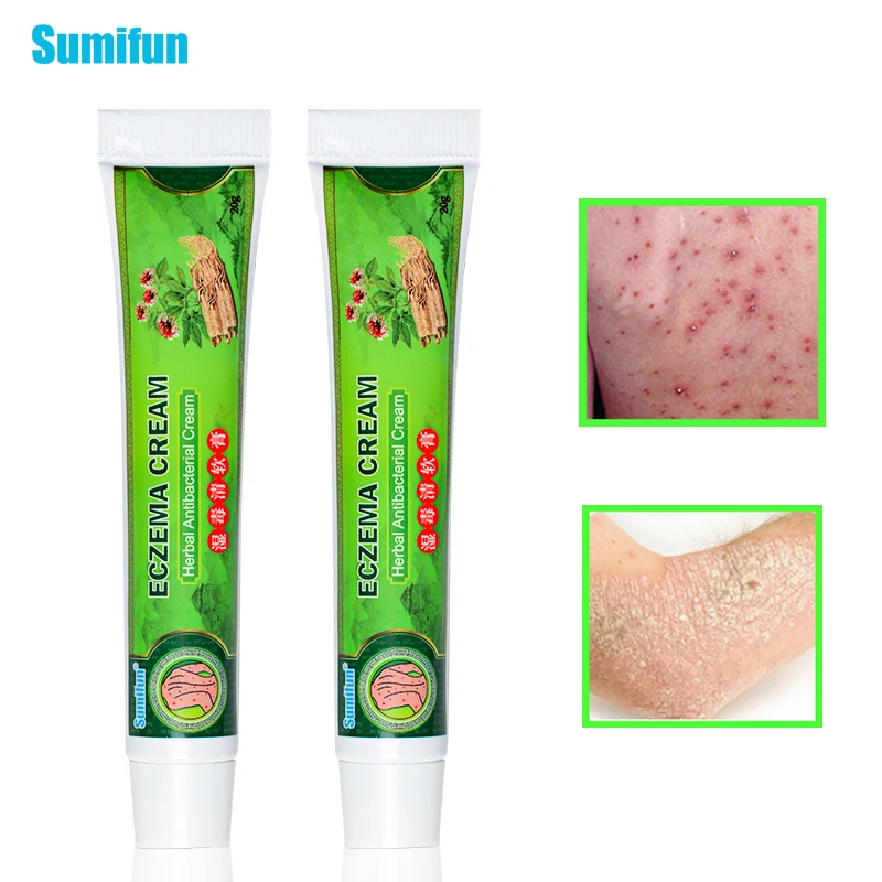 

1pcs Skin Problems Treatment Eczema Ointment Chinese Herbal Antibacterial Cream Analgesic Anti-Itching Plaster P1083