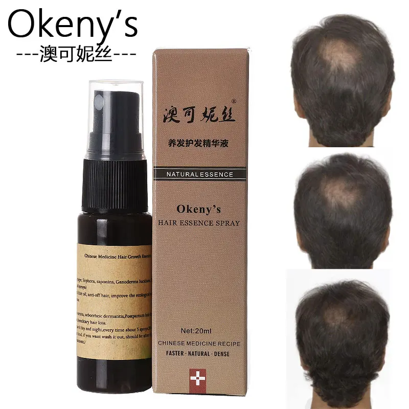 Okeny's Hair Growth Spray 20 мл жидкие продукты для быстрого роста волос Yuda Pilatory анти-седые волосы продукт для лечения выпадения волос