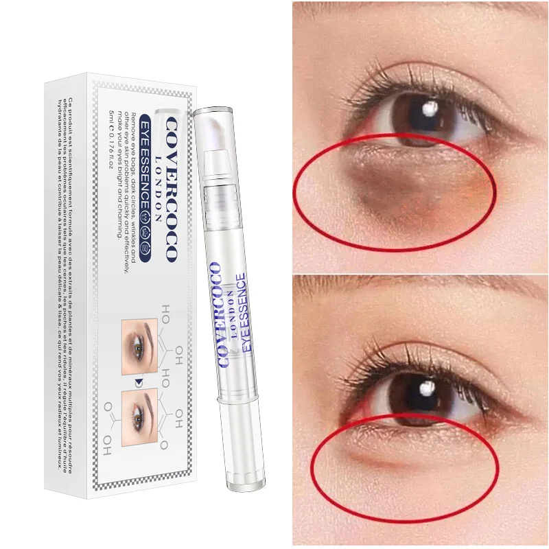 

10ml Hyaluronic Acid Eye Essence Eye Cream Anti Aging Anti Wrinkle Dark Circles Removal Cream Water Light Needle TSLM2