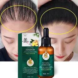Effective Hair Growth Spray Fast Grow Thinning Loss Scalp Repair Hair Beauty Health Products Dry Frizzy Damaged Treatment Care