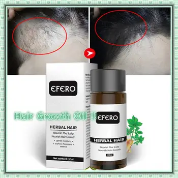 

Effective Ginger Extract Hair Growth Natural Oil Serum Hair Grow Fast Treatment Unisex Damaged Hair Repair Anti-Dandruff Serum