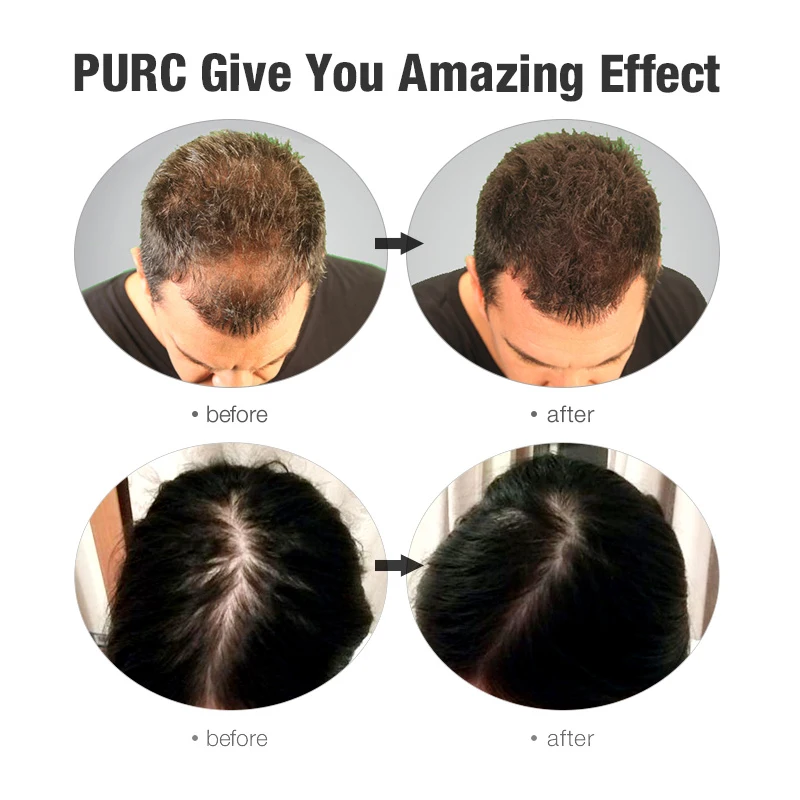 growth hair oil 