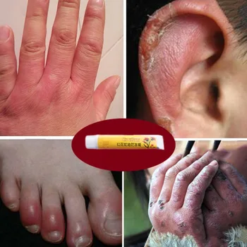 

Hand Foot Crack Cream Repair Chapped Peeling Skin Anti Cracking Wrinkle Treatment