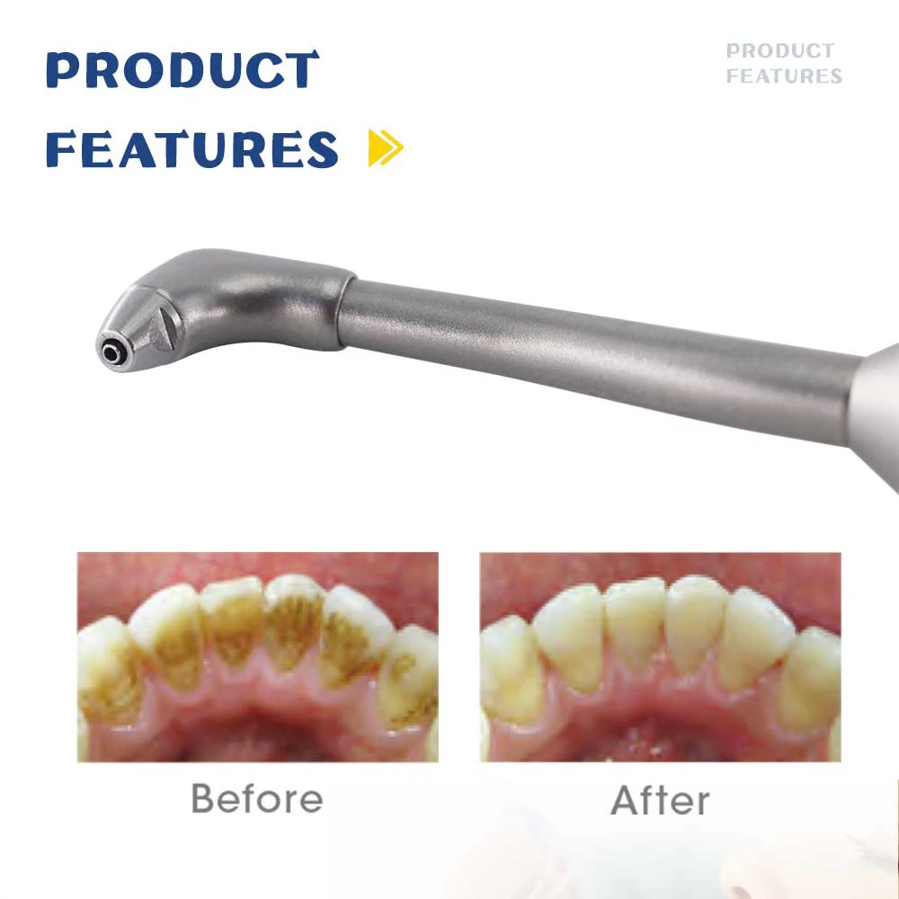 Prophy Jet Teeth Cleaning edu.svet.gob.gt