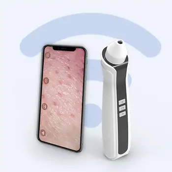 

1pc Visible Blackhead Remover USB Portable Cosmetic Instrument for Women