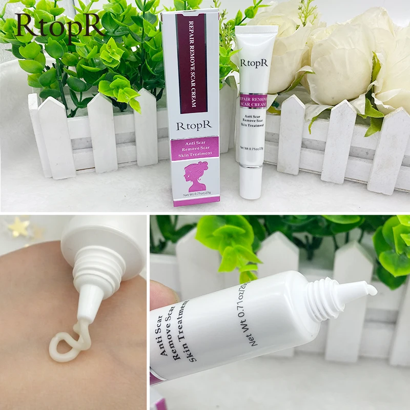 rtopr repair remove scar cream