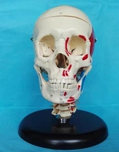 

skull color separation coding model Medical teaching aids free shipping