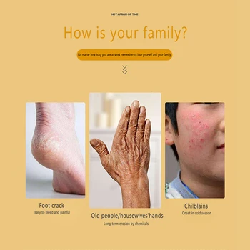 

High Effective Horse Oil Hand Foot Repair Cream Lasting Moisturizing Anti-crack Anti-Dryin Hand Foot Cream