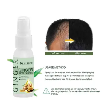 

Hair Care Help Regrowth Ginger Hair Regrowth Essence Intensive Spray Anti Loss Treatment Ginger Essence Natural Repair TSLM1