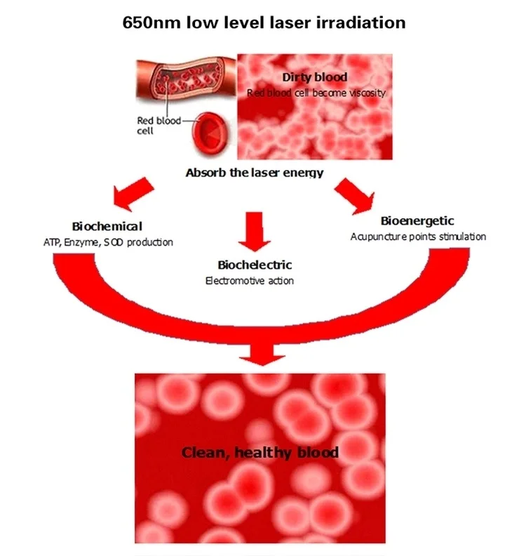 Best Tinnitus Ear Laser Therapy Watch Laser Acupuncture Machine Tinnitus/ Otitis/ear hearing problem 3