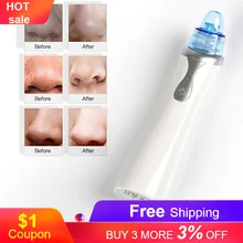 Черная точка вакуумная Usb зарядка черных точек оборудование для красоты ЖК-монитор глубокая чистка Удаление омертвевшей кожи женский аппарат для чистки лица