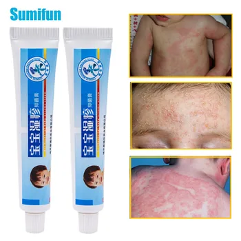 

1pcs Cream For Psoriasis Baby Eczema Herbal Ointment Dermatitis Antibacterial Cream Anti-iItching Pain Relief Plaster Skin Care