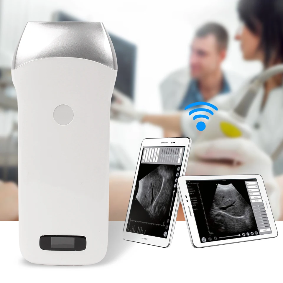  Portable Digital Ultrasound Probe Device GA(CRL)GA(BPD)GA(GS)GA(FL)GA(HC)GA(AC) Host AndroidiOSWind