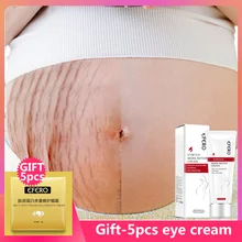 EFERO крем для удаления рубцов от акне крем для растяжек крем для тела от жира шрамов лечение растяжек крем для беременных