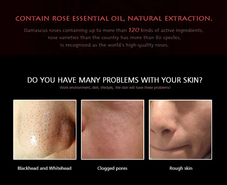 rose-blackhead-removal_03