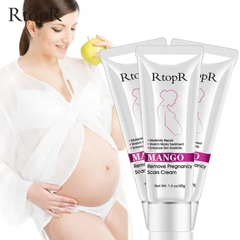 

3PCS/LOT Remove Pregnancy Scars Skin Body Cream Postpartum Stretch Marks Repair Cream Anti-Aging Skin Winkles Firming Body Cream