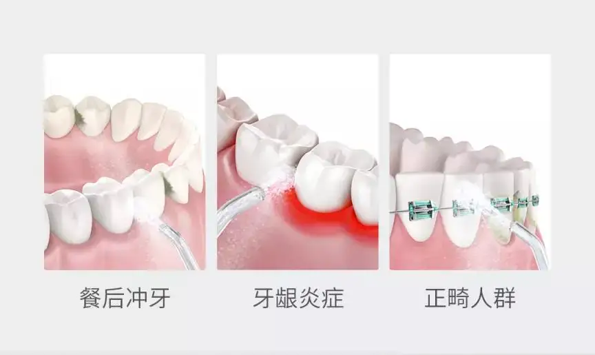 Xiaomi Mijia прямой беспроводной стоматологический очиститель Стоматологическое Масштабирование чистящий инструмент Электрический стоматологический очиститель стоматологический камень
