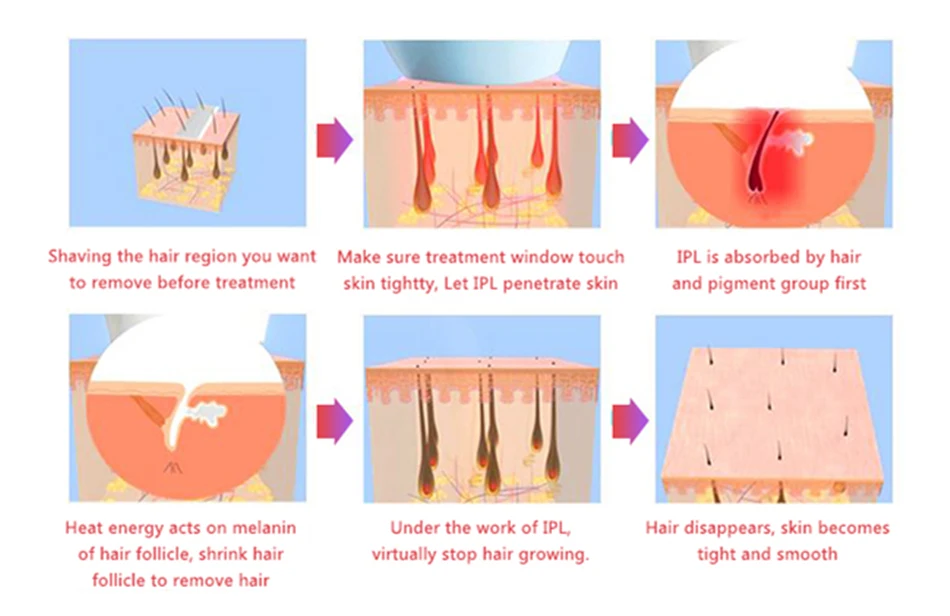 Lescolton IPL Перманентный Эпилятор безболезненный лазер для удаления волос 700000 импульсный светильник машина для удаления волос лицо подмышки конечности бикини