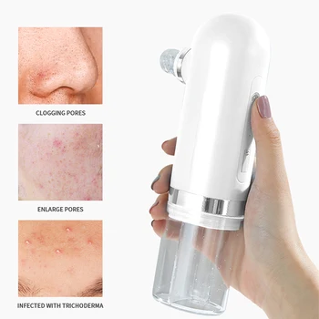 

Small Bubble Cleaner Electric Blackhead Remover Acne Pimple Facial Pore Deep USB Rechargeable Skin Care Tool Beauty Cleaning