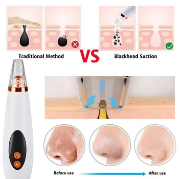 

Electric Acne Remover Blackhead Remover Face Deep Nose Cleaner Face Pore Vacuum Skin Care USB Rechargeable Tools Facial Suction
