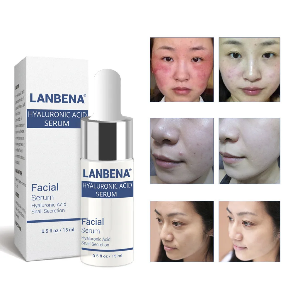 CNN80224437_20180228051920112