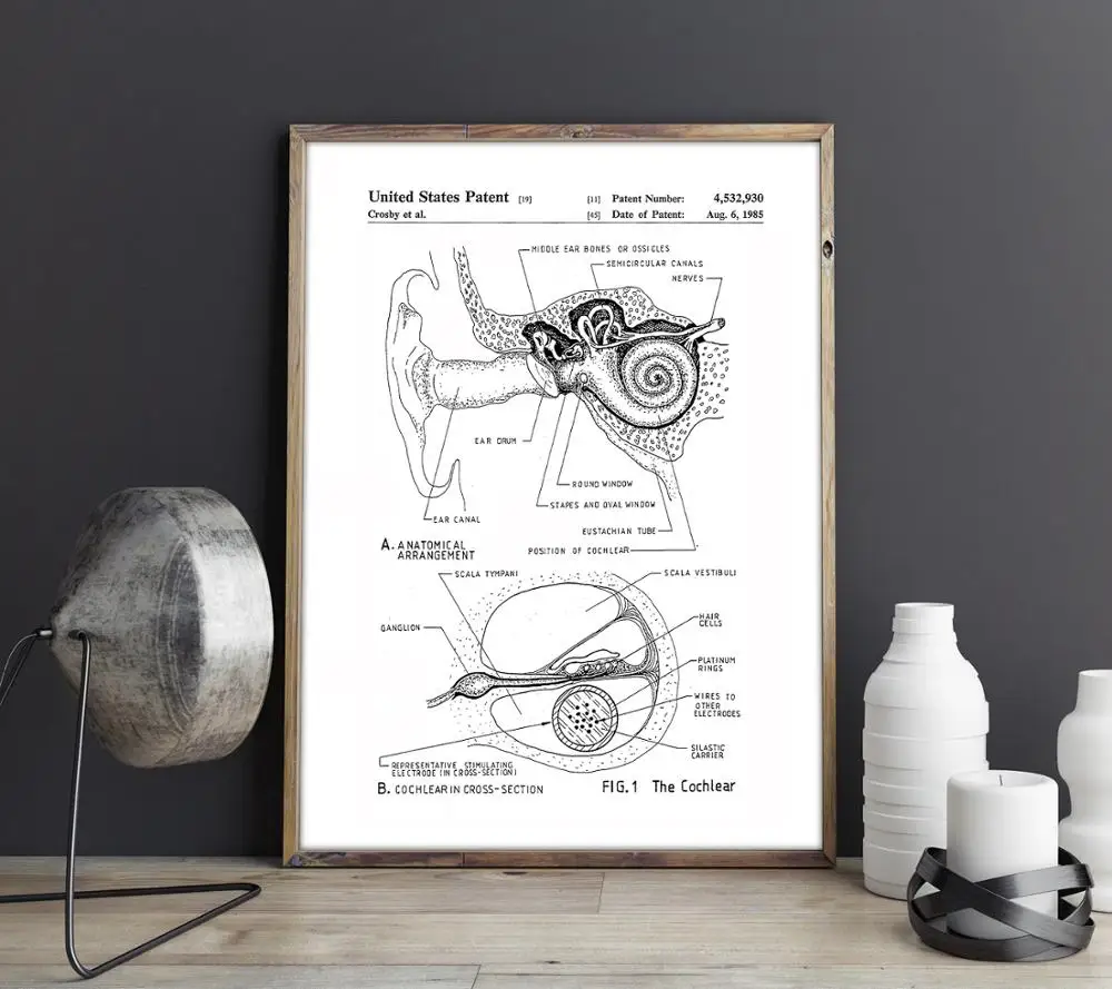 Cochlear Implant патент печати, ухо анатомический плакат, внутренний ушной диаграмма, аудиолога искусства, ЛОР подарок для врача, слуховой аппарат Декор