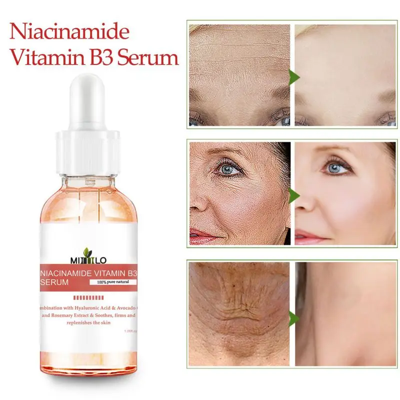 Niacinamide эссенция Увлажняющий Осветляющий пигмент удаляет веснушки осветляет кожу цвет лица Сыворотка