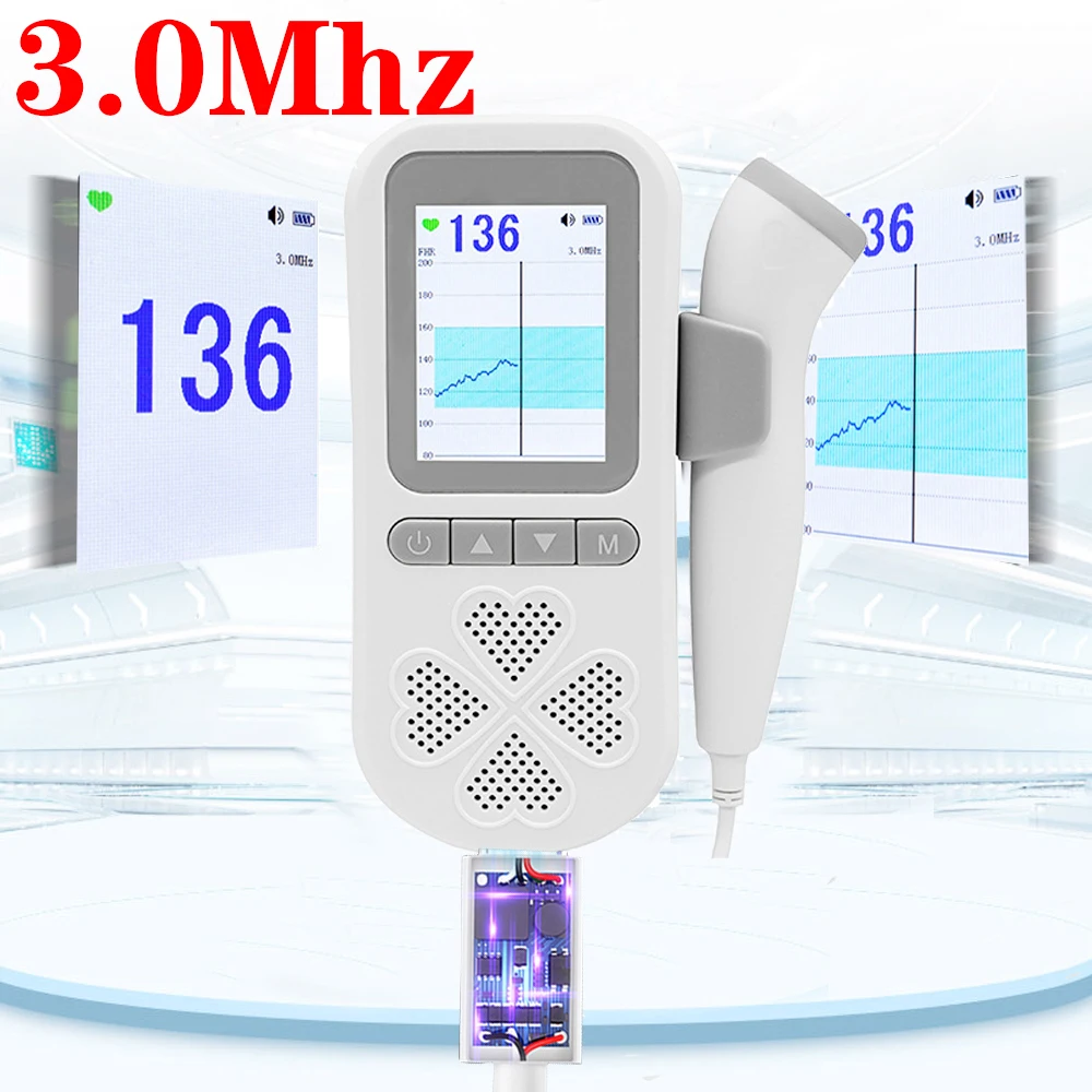Chargeable 3.0MHz Ultrasound Fetal Doppler Baby Heart Beat 0 Radiation Prenata Rate Monitor Pocket | Красота и здоровье
