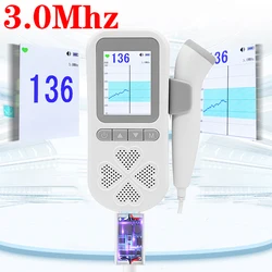 Chargeable 3.0MHz Ultrasound Fetal Doppler Baby Heart Beat 0 Radiation Prenata Doppler Baby Heart Rate Monitor Pocket Doppler
