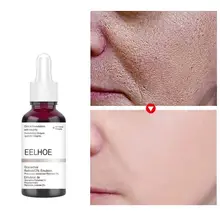 

Salicylic Acid Shrink Pores Face Serum Fruit Acid Anti Acne Exfoliating Pore Smooth Essence Moisturize Nourish Skin Repair Care