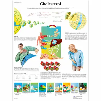 

Anatomy Pathology Anatomical Poster Cholesterol Chart Classic Canvas Paintings Vintage Wall Posters Stickers Home Decor Gift