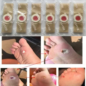 

30pcs Foot Plaster Corn Removal Pads Medical Plasters Warts Thorn Patch Curative Patches Calluses Callosity Detox Foot Patches